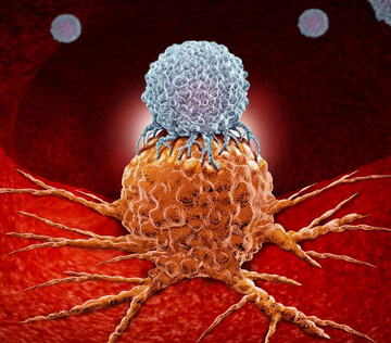 Прорыв в лечении рака мочевого пузыря: терапия антителами увеличивает выживаемость пациентов вдвое