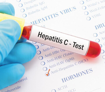 Минздрав предложил проверять на гепатит С в рамках медосмотров