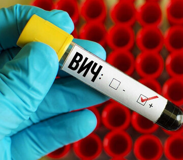 Ученые выявили возможные причины низкоуровневой виремии ВИЧ на фоне лечения