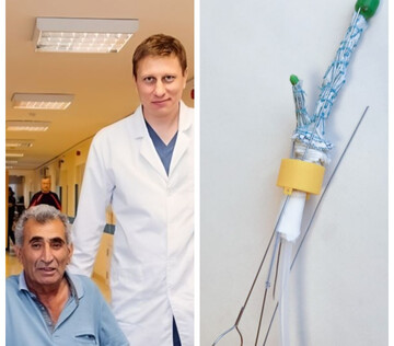 В Новосибирске установили первый отечественный протез аорты с ответвлением для артерий