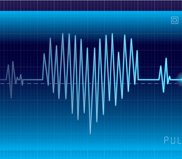 Первую в стране радиочастотную аблацию зоны желудочковой тахикардии эпикардиальным доступом провели в Перми
