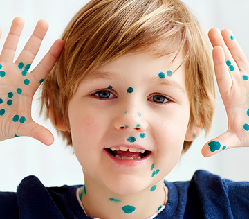 В России стремительно растет заболеваемость ветрянкой