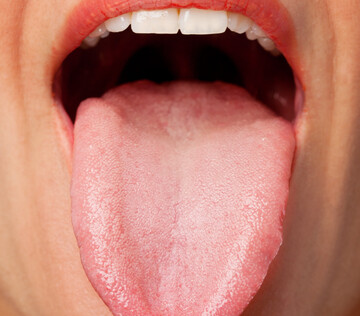 В Волгограде разработали уникальный метод раннего выявления онкологии полости рта