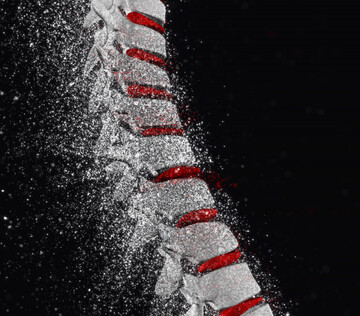 Международная команда изучила изменения костей на ранней стадии остеопороза