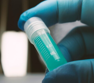 Экспресс-тест на бруцеллез разработали в России