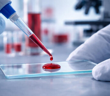 Платформу для лечения редкого типа гемофилии разработали в России