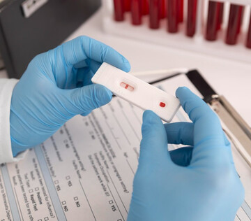 Ученые научились диагностировать опухоль мозга по анализу крови