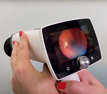 ИИ-систему для диагностики диабетической ретинопатии выводит на рынок СибГМУ